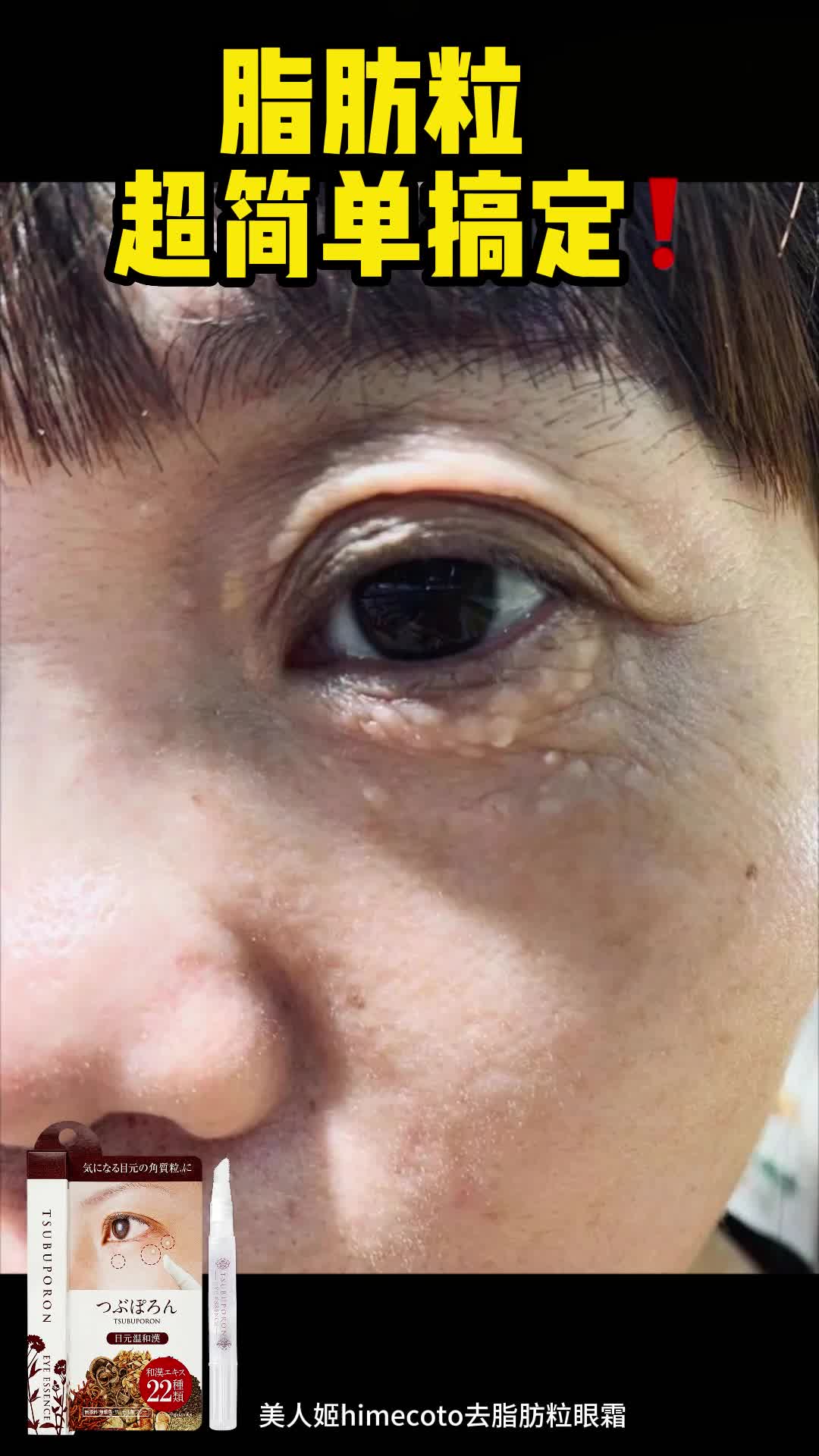 SLINKYTOUCH眼霜怎么样好用吗脸上有脂肪粒的都给我去买它！_什么值得买